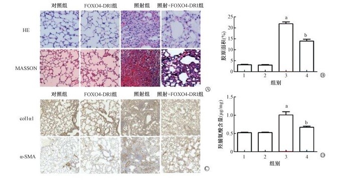 Figure 2 FOXO4-DRI attenuated RIPF in mice A. HE staining and MASSON staining of lung tissue ×200; B. The percentage of collagen area in the lung tissue with MASSON staining