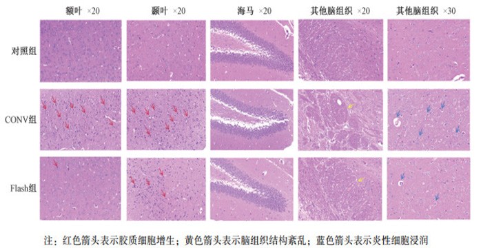 Transcriptome analysis of radiation-induced brain injury in mice subjected to Flash whole-brain irradiation with electron beams